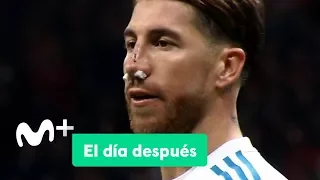 El Día Después (20/11/2017): La nariz de Ramos