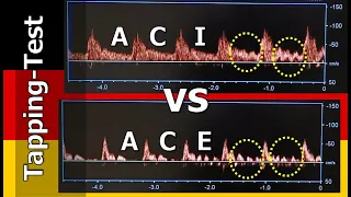 Video 21: Der Tapping-Test - Unterscheidung A.  carotis interna vs externa