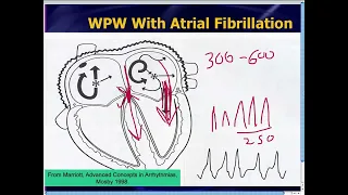 Amal Mattu's ECG Case of the Week_ Nov 25, 2013