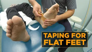 Quick Relief For Fallen Arch Pain With This EASY Taping Method | Taught By Expert Physical Therapist