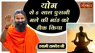 योग से 6 साल पुरानी गले की गाठं को ठीक किया ~ Swami Ramdev Ji !! Health Video ! Yog And Ayurved