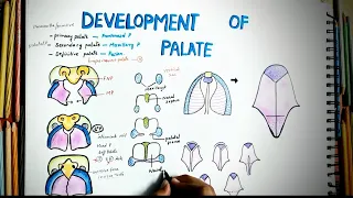 Development Of Palate || Embryology || Easy Explaination || Cleft Palate || Defective Development