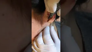 Пирсинг хряща( трагус)Cartilage piercing (tragus)