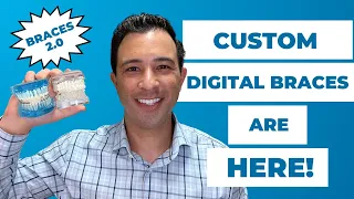 Next Generation Braces Are Here! Digital Custom Braces Explained by Dr. Robert Passamano