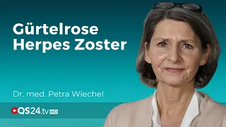 Gürtelrose Herpes Zoster   was man wissen sollte Dr  med  Petra Wiechel Visite QS24