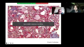 Патологическая анатомия легких при COVID-19. Лекция д.м.н. Марии Викторовны САМСОНОВОЙ