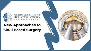 New Approaches to Skull Base Surgery