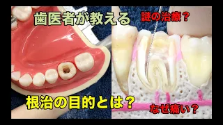 [Yokohama Totsuka Naito dentistry] Explanation video of Neji② What is the purpose of Neji?