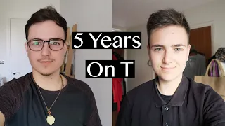 5 Years On Testosterone - FTM Trans