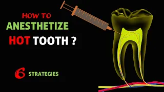 How to Anesthetize hot tooth