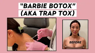 I Got Barbie Botox (or “Trap Tox”) For Migraines | Susan Yara