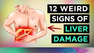 12 Weird Signs of LIVER DAMAGE