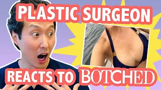 Uniboob?!?! Plastic Surgeon Reacts to BOTCHED