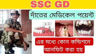 SSC GD সম্পূর্ণ দাঁতের মেডিকেল | দাঁতের মেডিকেলের কোন কন্ডিশনে আনফিট করা হয়।