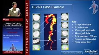 Endovascular Management of Thoracic and TAAA (Brian DeRubertis, MD)