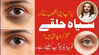 Bye Bye Dark Circles: Effective Home Remedies and Tips || How to Remove Dark Circles Under Your Eyes