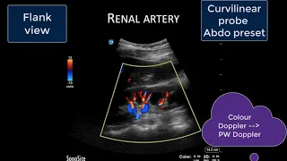 Solid Organ Doppler Assessment of Venous Congestion