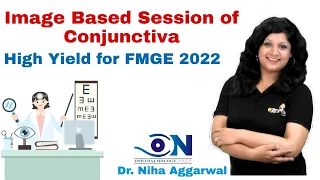 Image Based Session of Conjunctiva || Dr. Niha Aggarwal