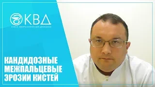 1413  Кандидозные межпальцевые эрозии кистей