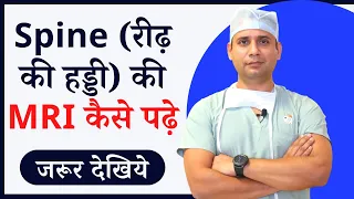 how to read spine mri at home /  Dr naveen ne samjhaya scitica me mri kaise pata chalta hai