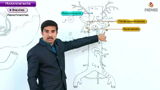 Abdominal Aorta - Gross anatomy  ( Origin , Course , Branches ) :  USMLE Step 1