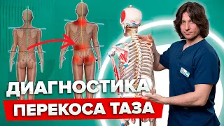 Как ОПРЕДЕЛИТЬ перекос ТАЗА самостоятельно? Не допускайте смещение таза