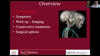 Cervical Disc Disorders with Radiculopathy and Surgical Options | Traumatic Spinal Cord Injury