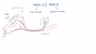 HSV 1 and 2 - Pathogenesis of Oral and Genital Herpes