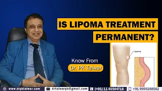 Is Lipoma Treatment Permanent? Lipoma का इलाज Permanent होता है क्या? Dr. PK Talwar