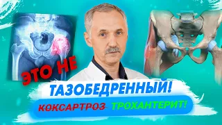 Лечим  тазобедренный сустав и нет эффекта? Возможно, это трохантерит / Доктор Виктор