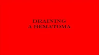 Try Not To LOOK!!! Hematoma Draining!!