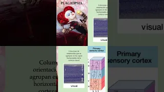 Fisiopatología del Síndrome de Alicia en el País de las Maravillas.