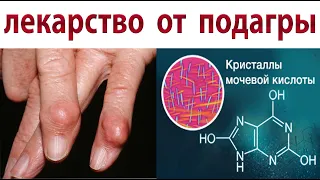 Все Врачи пьют этот чай. Снижает уровень мочевой кислоты и лечит подагру