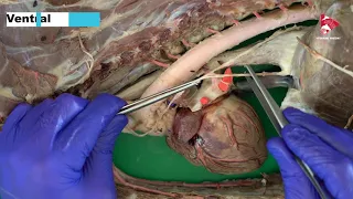 Anatomy of the Vagus and Sympathetic Trunk inside the thoracic cavity