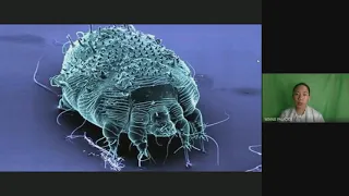 WHAT IS SCABIES| MICROBIOLOGY & PARASITOLOGY