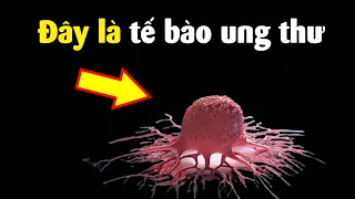 Bệnh ung thư có gì mà Y học bó tay?