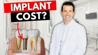 How much are Dental Implants 🦷