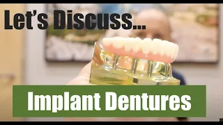 Implant Dentures - "All on 4" or "Locator Dentures"