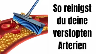 Das sind die besten natürlichen Mittel, um verstopfte Arterien zu reinigen!