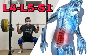 HERNIAS DISCALES Y SENTADILLA - SE PUEDE HACER? Tengo L4 - L5 - S1