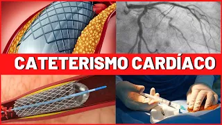 CATETERISMO CARDIACO e  ANGIOPLASTIA | COMO É FEITO | RISCOS | INDICAÇÕES | O QUE VOCÊ TEM QUE SABER