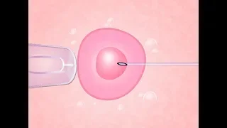 Fertilização in vitro: O Passo a Passo