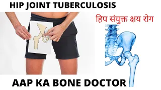 TUBERCULOSIS OF THE HIP. EPISODE 5