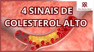 4 Sinais que seu corpo dá sobre COLESTEROL ALTO!