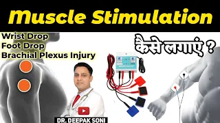 What is Muscle Stimulator Therapy in Hindi | How to Use Muscle Stimulator machine | Physiotherapy