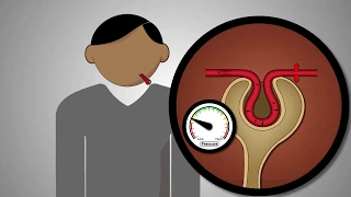 Keeping Kidneys Safe - Know How Medicines Affect the Kidneys