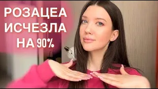 Как я вылечила розацеа за 4 месяца на 90% | Часть 2