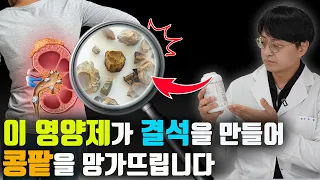 이 영양제가 콩팥에 돌을 만들어서 혈관을 막고 콩팥을 망칠수 있습니다 (요로결석, 신장결석의 원인이 되는 영양제, 요로결석 회피하는 방법)