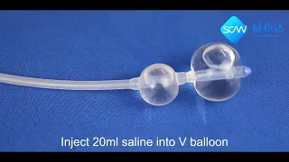 Induction With Balloon | How To Use Cervical Ripening Balloon | SCW Medicath