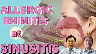 Allergic Rhinitis at Sinusitis - Payo ni Doc Gim Dimaguila at Doc Willie Ong #14c